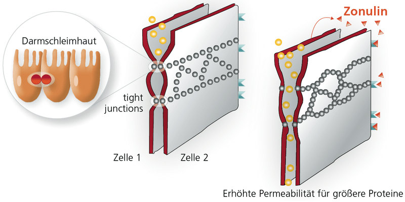 Darmdiagnostik