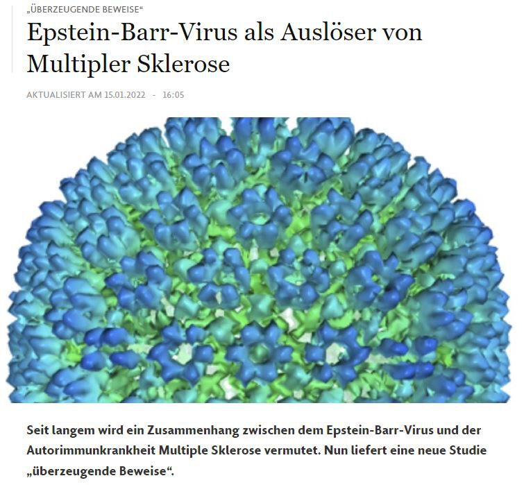 Spannende Bestätigung unserer Therapiemethode: EBV als Auslöser bzw. Trigger der Multiplen Sklerose