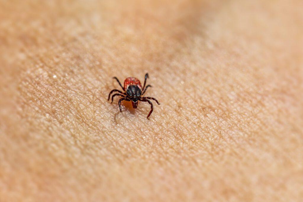 Borreliose – Langzeitfolgen durch langlebige Bakterienreste